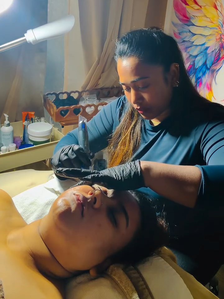 Microneedling treatment at Alagee Facial Care in Brampton